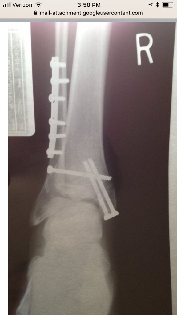 jeff mathesius tweet media