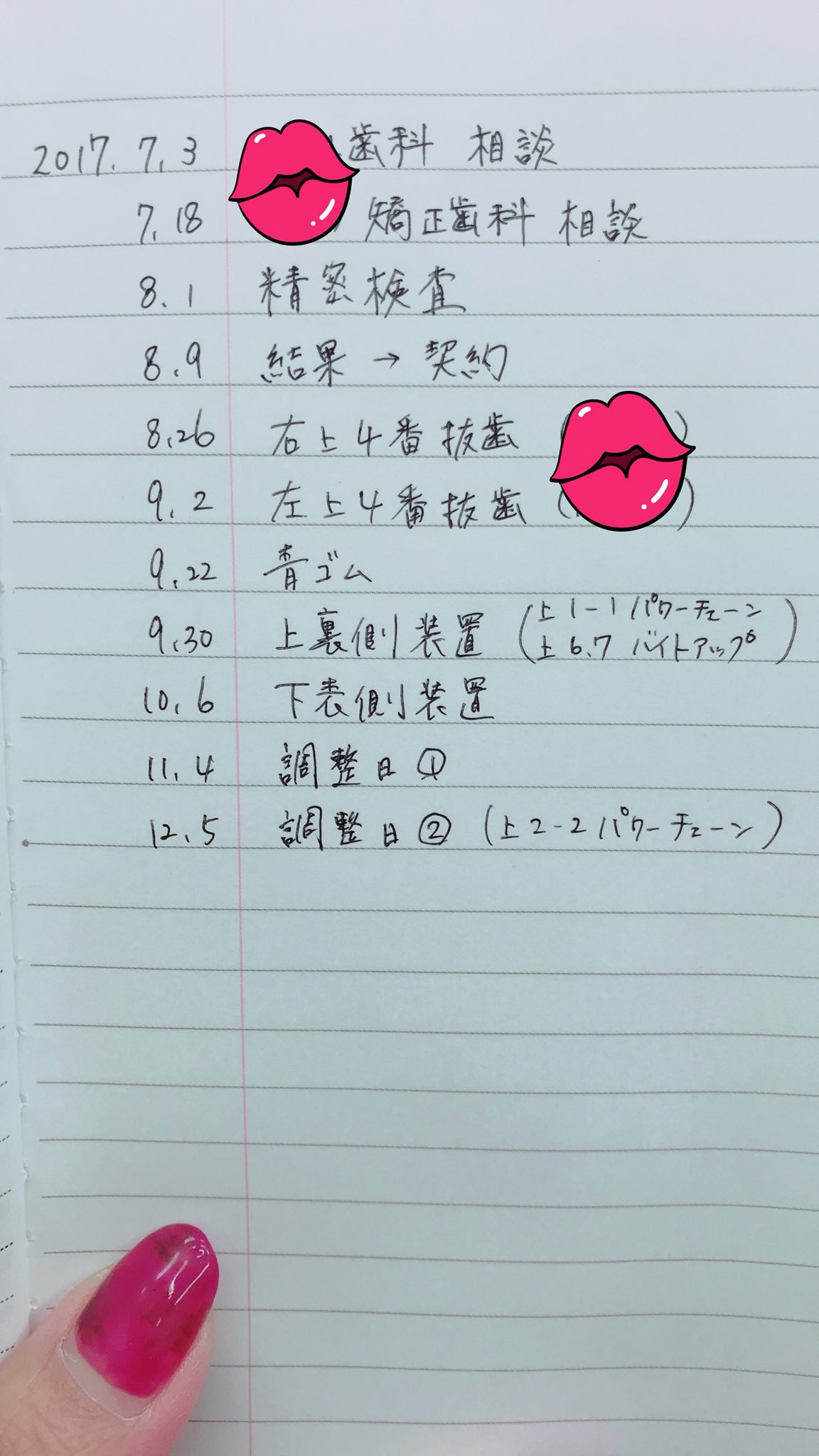 あず 歯列矯正リテーナー戦士 こんなスケジュールでした 1月から手帳変えるから書き移そ アナログw 歯列矯正 手書き矯正予定表 T Co Krqeprnpy3 Twitter