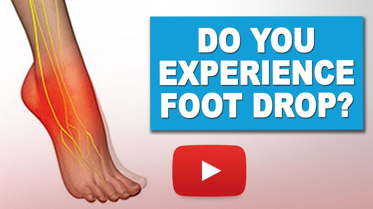 msworkouts's tweet photo. Wow! Never expected to receive so many views and inquires from our exercise video on Foot Drop! If you haven't seen it, here is the link! Thanks for all of the support!
#MultipleSclerosis #FootDrop #MSWorkouts #MSWarrior #MSSupport #Health #Wellbeing
https://t.co/Ha4nABATTi https://t.co/FNqgh1rar4