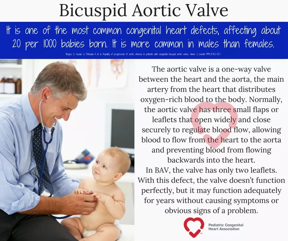 22qAwarenessDay's tweet photo. Bicuspid Aortic Valve #CHD
2 cusps not usual 3
Affects 1-2% gen popn

70% #22q11.2DS have #CHD

IAA &amp; COA common. BAV in >50% of these indiv https://t.co/0ph08Vd9Wm