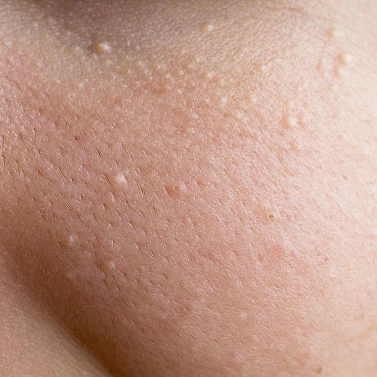 WomensHealthMag's tweet photo. What's that on your face? https://t.co/AooRKcLr67 https://t.co/Z14W0ghDuc