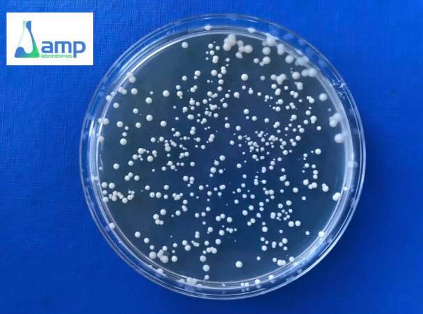 AMPLaboratorios's tweet photo. 🍻LEVADURA DE CERVEZA🍻Saccharomyces cerevisiae, tiene gran valor nutricional. Contiene #carbohidratos #proteínas #minerales y #vitaminas. Tiene acción inmunoestimulante, antitumoral, antianémica, digestiva, cicatrizante, hepatoprotectora y analgésica.

#AMPLaboratorios https://t.co/5a8K3JDplv