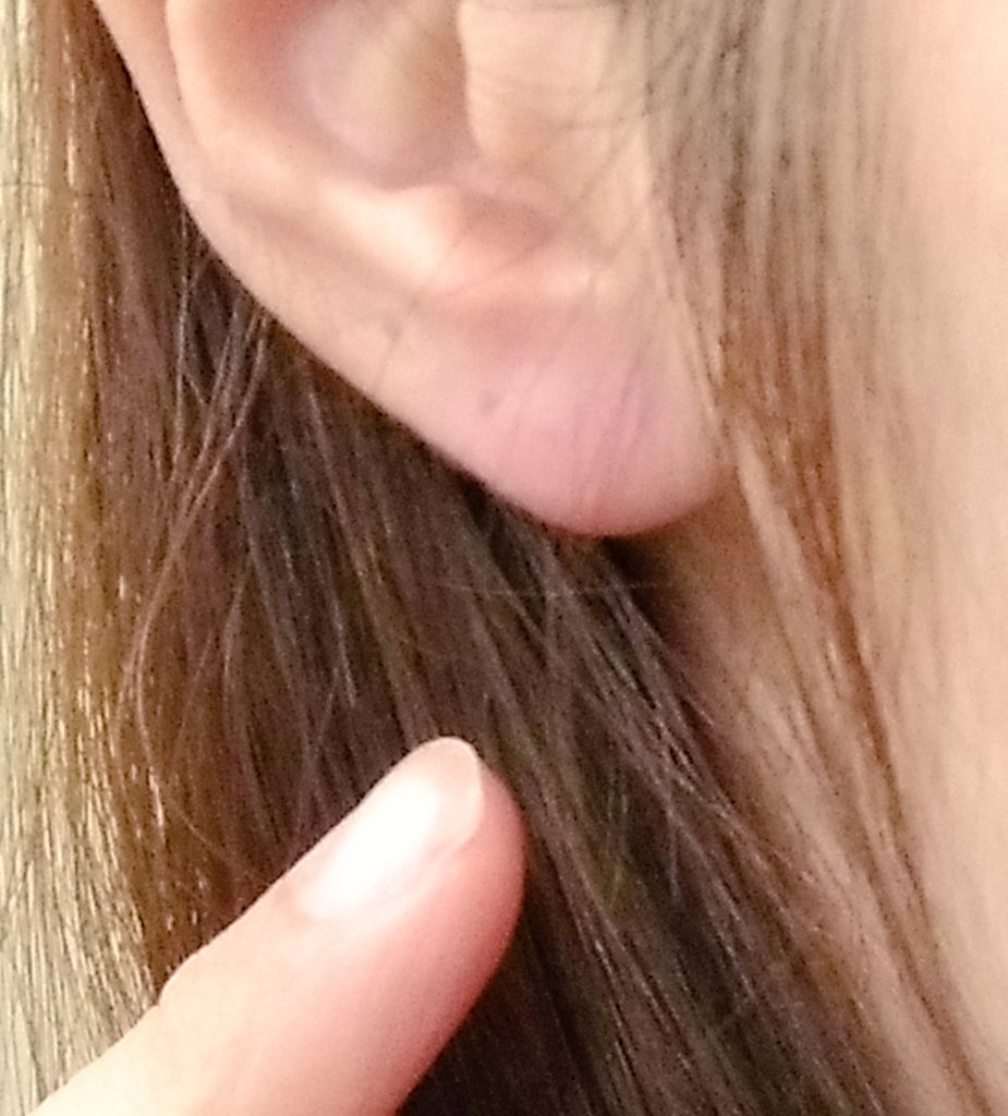 腫れる 耳たぶ 耳たぶがかゆい４つの原因とは！病気の可能性も・・！