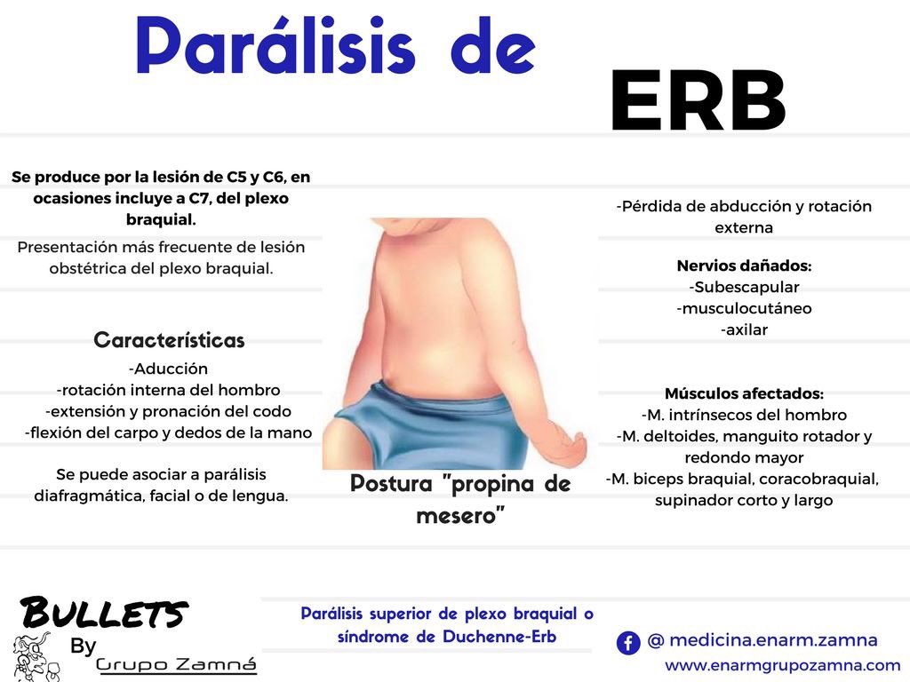 parálisis de erbs