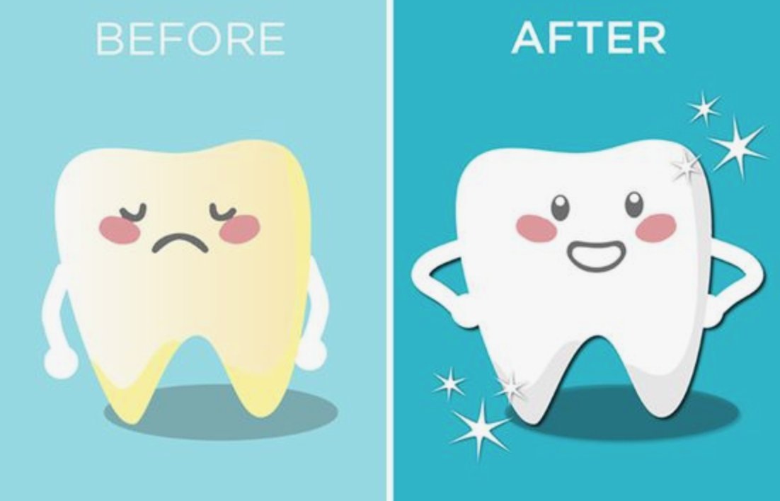 FoothillsVista's tweet photo. As the end of the year approaches, start thinking about your new year resolutions! A great resolution is to have whiter teeth. We offer teeth whitening to brighten up your smile. https://t.co/598rmvGcjQ