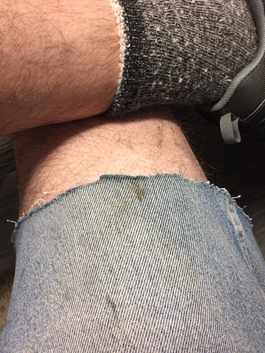 LochlinCross's tweet photo. I just realized the jeans shorts I got from @GrantTheJohnson for Xmas has blood stains on it. Nothing says MERRY XMAS like blood stains. #TheLOCKERRROOM https://t.co/wFoxxZbSWs