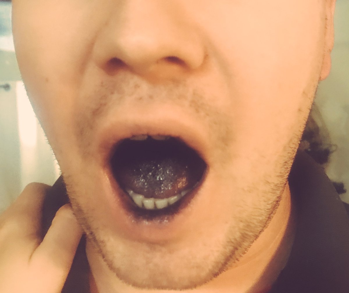 TheChemistryFox's tweet photo. Update: Black icing stains your mouth π±. We both have scared our son in this process. ππ€£π. The harder we laugh, the more black teeth are showing and the more scared the baby gets. #parentingfail #icingproblems https://t.co/IdYfBLyXRC