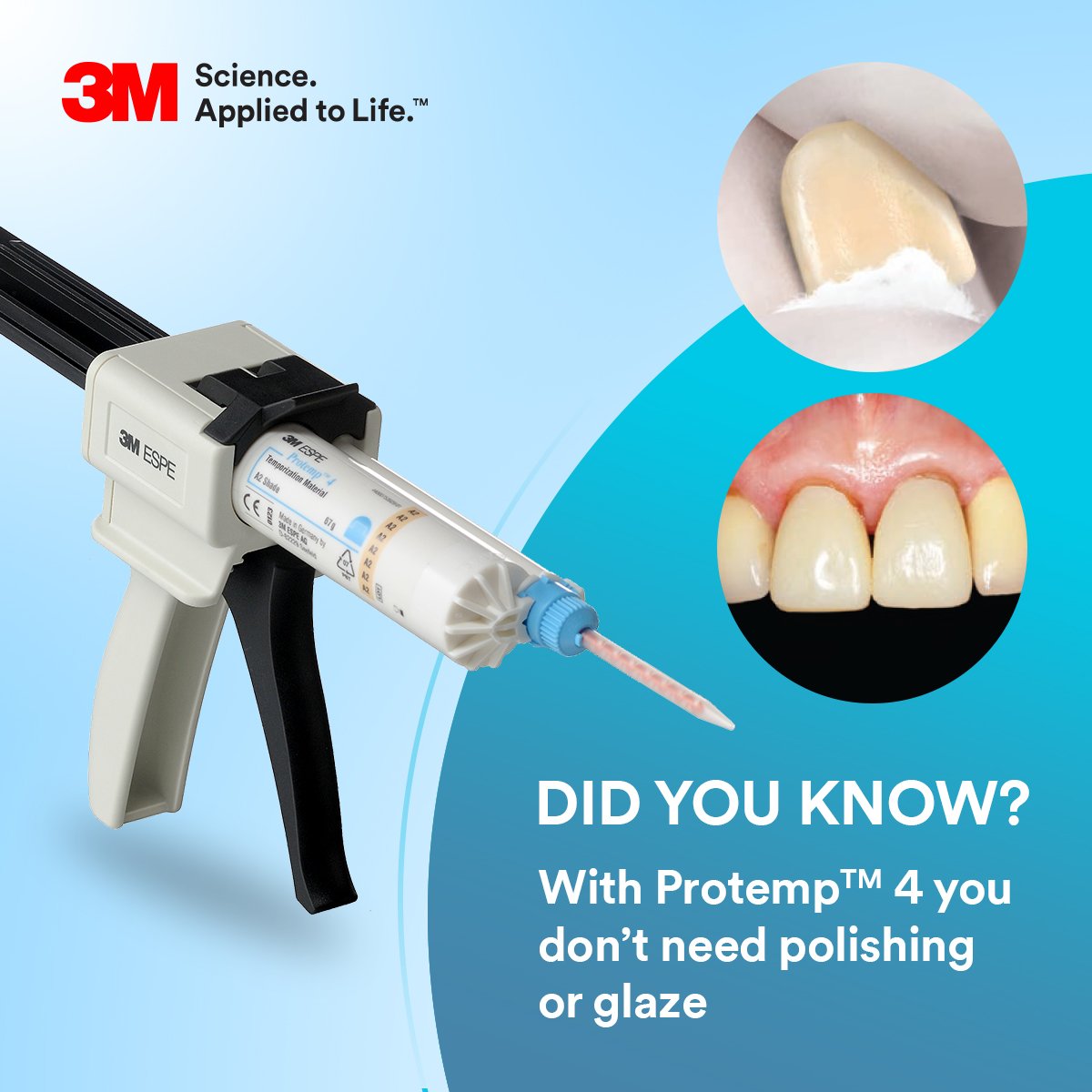 3MOralcareIndia's tweet image. No polishing? No problem? Protemp 4 temporization material ensures highly durable and aesthetic temporary restorations of all kinds, including long-term temporization. Smooth and Natural Teeth-like restorations.  
#Strong&amp;amp;Long #Protemp4 #3MOralCareIndia