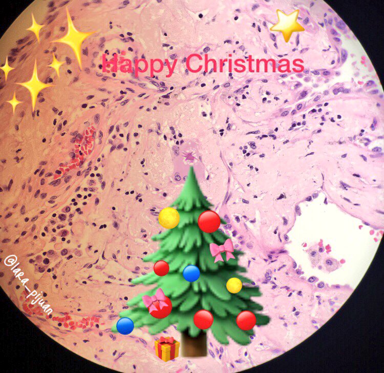 lara_pijuan's tweet photo. Happy holidays to all my twitter’s friends 🤗  Feliz Navidad 🎄 Bon Nadal 🎁 Feliz Natal ⭐️ Buon Natale 🎊 Joyeux Noel 🥂 #HappyHolidays2017                                 #Christmas2017 #pathart #pulmpath #pathologists https://t.co/RzPkrQ2lol