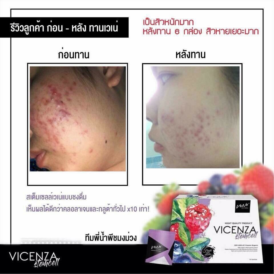 littlebun_shopp tweet media