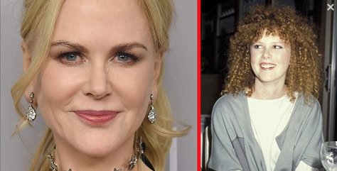“Nicole Kidman — Adding Up Her Plastic Surgery By The Numbers! https://t.co...