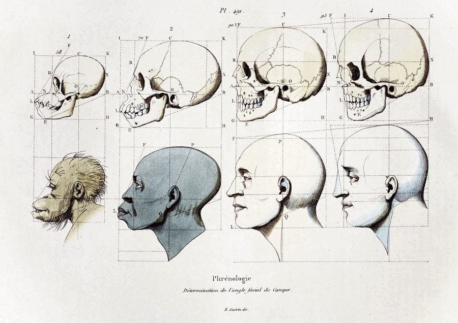 Planches anatomiques diverses du début du 20ème siècle suggérant la proximité entre singes et personnes noires et l'éloignement entre personnes noires et personnes blanches : des crânes sur les 2 premières images ace les faciès correspondants puis différentes espèces d'animaux sur la 3ème avec l'être humain noir entre le singe et l'être humain blanc.