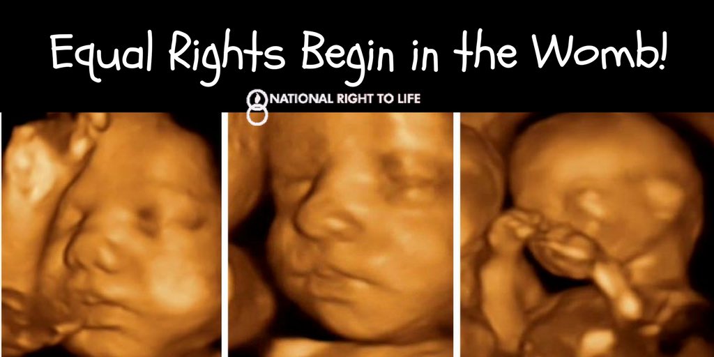 #GoldenGlobes2018 #TIMESUP