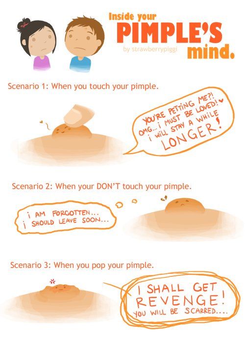 AcneSkinSite's tweet photo. Inside Your Pimples Mind... https://t.co/Aku4Sv6vah