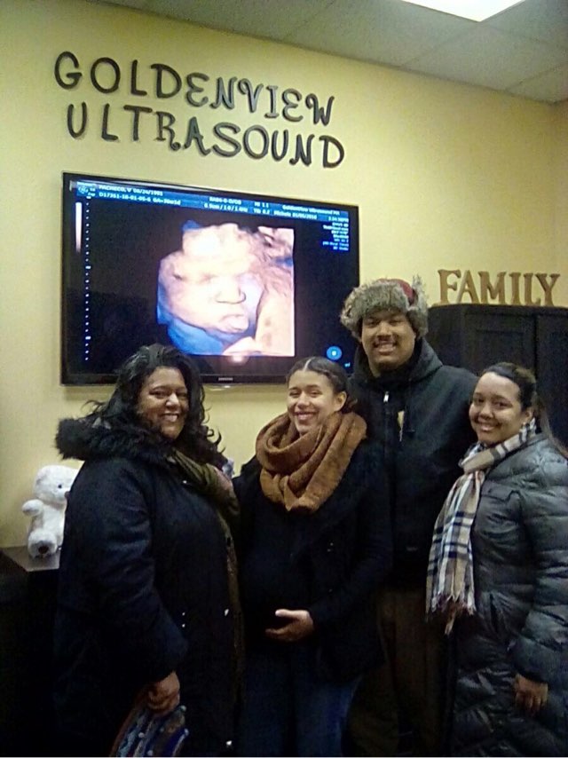 3dUltrasound's tweet photo. Never a dull moment at Goldenview Ultrasound. We caught this little cutie sticking out it’s tounge. #expectingin2018 #3dultrasound https://t.co/o2UykXsJZ0