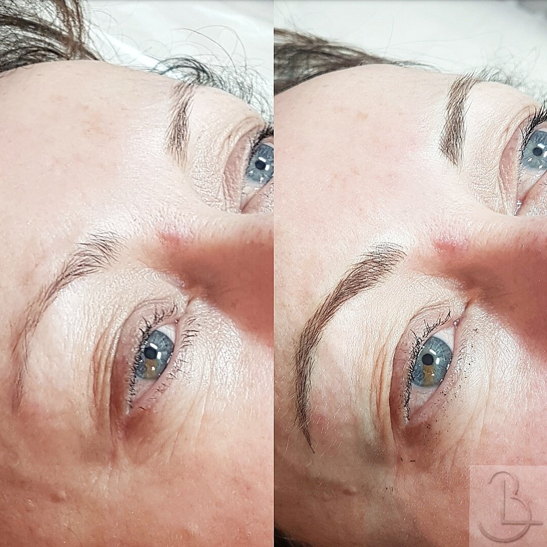 BethLouisaPC's tweet photo. Janette wanted to keep her natural brow shape so we added just enough strokes to define and added a little bit of length to the tail.
A beautiful enhancement 😍
#blbrows #browconfidence #micropigmentation #tattoo #uksocialmedia #uksmallbiz #beauty #Derby #Westbridgford #Notts https://t.co/NvIGdBWOs3
