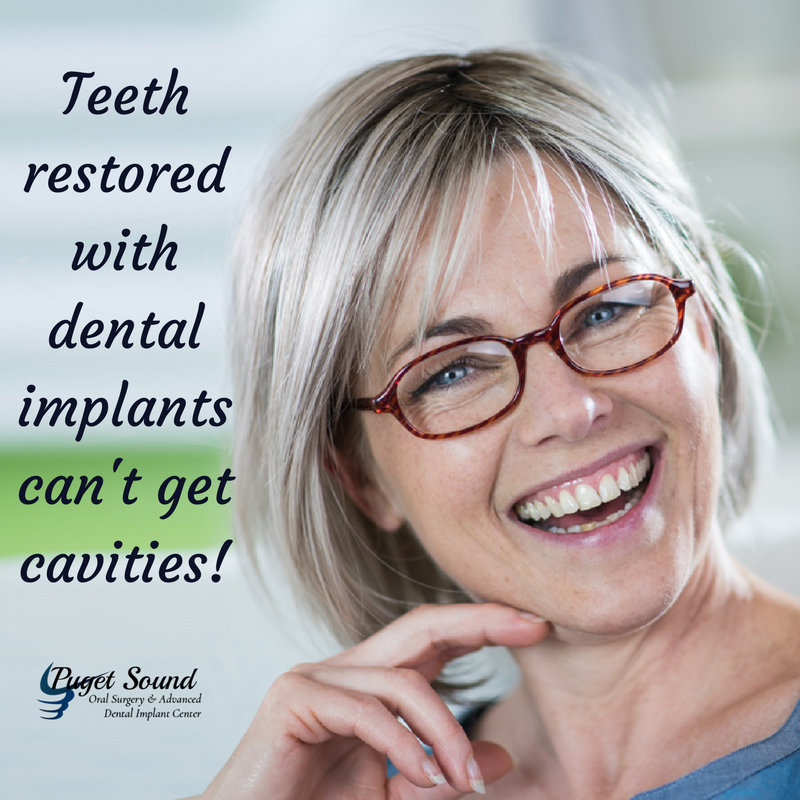 ps_oralsurgery's tweet photo. Teeth restored with dental implants can't get cavities! #PSOMS #Dental #Implants https://t.co/RYNJkhu54L