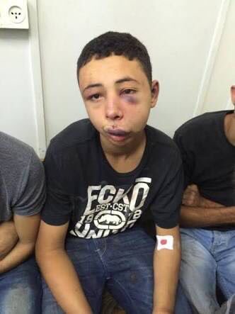 Terör devleti İsrail gözaltına aldığı çocuklara işkence ediyor.Göz altına aldığı çocukların bir çoğundan da haber alınamıyor...