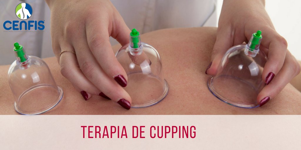CenfisV's tweet photo. El #cupping o también conocido como #terapiadeventosas es una práctica curativa que permite favorecer la circulación sanguínea y linfática. Utilizada por muchos #atletas como alternativa para relajar los músculos.
#fisioterapiavenezuela #nuevastecnicas #mesopotamia #cenfis_ve https://t.co/Cbf2NxjWtL