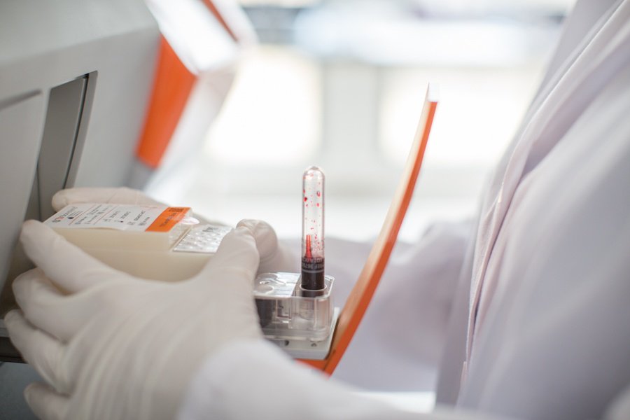 T2Bio's tweet photo. Watch Dr. Sandy Estrada of Lee Health System, Florida present patient case studies on T2Candida Panel at #ECCMID2017 https://t.co/o61OeS4e83 https://t.co/uc2maEVkSL