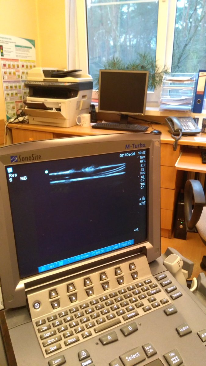 rubbadoc's tweet photo. Mold ready, smells fabulous (black currant). Now #USGIV #POCUS time #ultrasound #anestheticadventures Interns happy. https://t.co/Ium2BerWbH