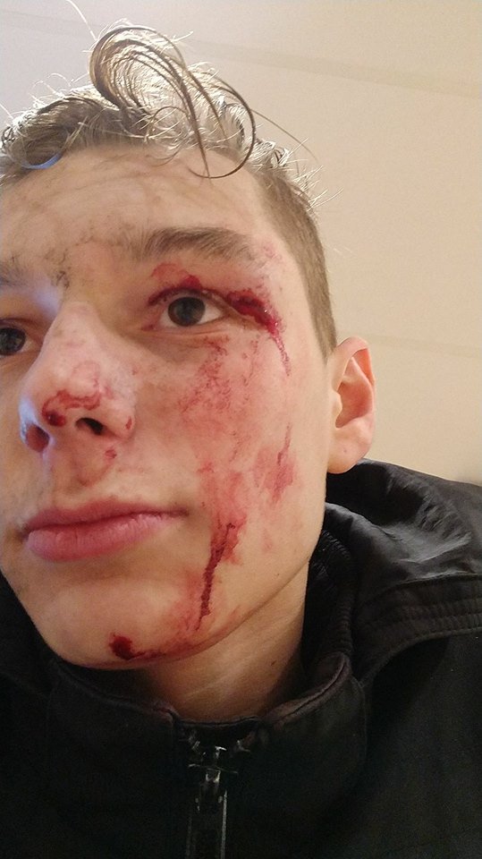 LindersWilbert's tweet photo. In de nacht van donderdag op vrijdag rond een uur of 4 is Coen Heesakkers gevallen! 2 jongens wss v Turkse afkomst)hebben hem naar t ziekenhuis gebracht en thuisfront gebeld. Gewacht tot er iemand kwam. Een heette Tarik. Coen wil bedanken. Wie waren het?  RT https://t.co/3mSGHzg4yQ