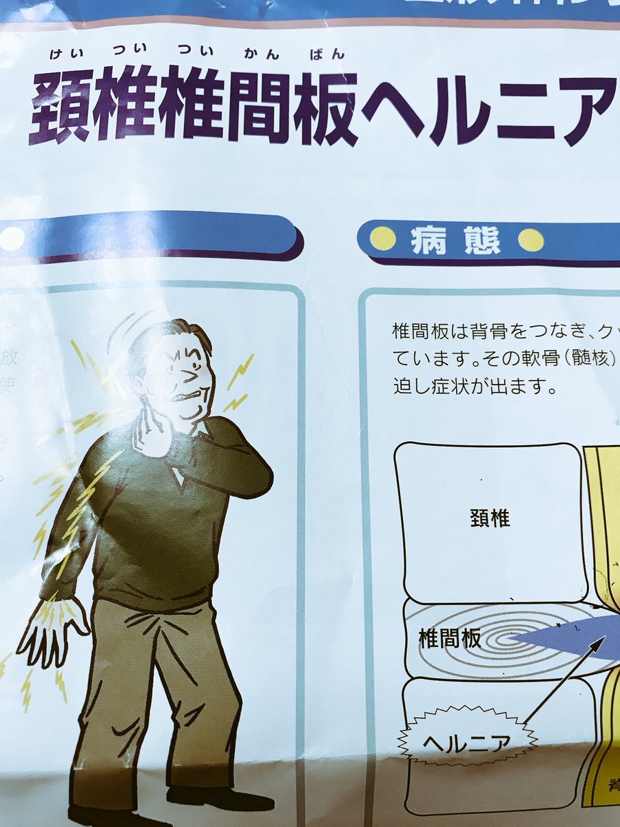 室姫 深 児島 実 בטוויטר とうとう来てしまったね 腰より先にこっちか 右はまだ肩だけ 左は二の腕と肩甲骨に痛み 指先が5本共痺れて親指はちょっと感覚もない箇所が 骨のヘルニアです さようならヘドバン ドクターストップです 室姫 深 児島 実 בטוויטר とうとう来てしまったね 腰より先にこっちか 右はまだ肩だけ 左は二の腕と肩甲骨に痛み 指先が5本共痺れて親指はちょっと感覚もない箇所が 骨のヘルニアです さようならヘドバン ドクターストップです