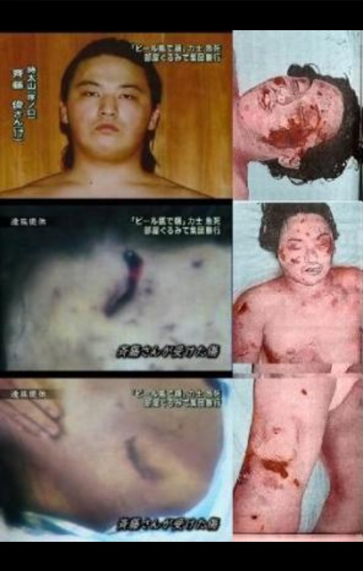 前田慶次 こういう前例がありますからね 07年に時津風部屋で ビール瓶や金属バットの集団リンチで殺された時太山 17 の 時 親方と協会と警察がグルになって無断で証拠遺体を火葬しようとした件 父親がギリで止める を見てるから 貴乃花親方が相撲協会