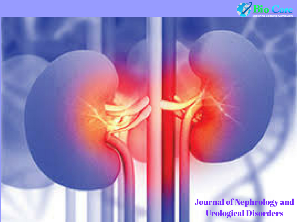 Biocore_Ijnu's tweet photo. Do you wish to submit your research in the best Nephrology journal, it is here https://t.co/M8aYbK1IAG
#Biocore_Group
#Biocore_Open_Access_Journals
#IJNU
#Nephrology_Journal https://t.co/eQ5gi1umAo