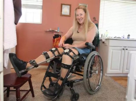 Transabled - liberals literally cutting off limbs to be disabled