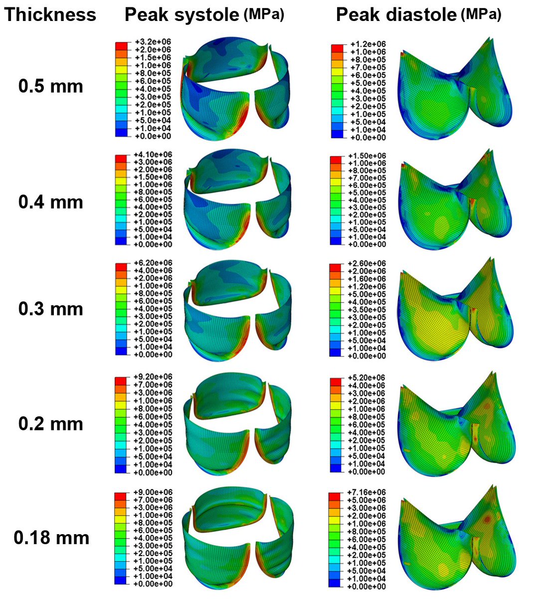 J Heart Valve Dis On Twitter Hyr Tavi Stress Analysis Of Transcatheter Aortic Valve Leaflets Under Dynamic Loading Effect Of Reduced Tissue Thickness Https T Co 4xwa4yt5qf Https T Co Gjchagljv1 Twitter
