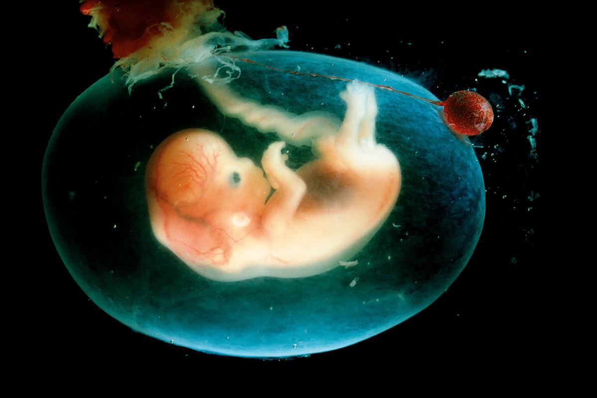 newscientist's tweet photo. 2018 preview: Gene therapy treats disease while in the womb https://t.co/yjp9gepb80 https://t.co/NAttxQwXbg