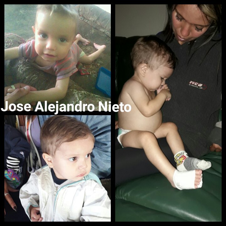 MamaLisVzla's tweet photo. #ServicioPublico URGENTE para José Alejandro Nieto de 2 años, se requiere Albúmina Humana al 0,5. La persona que la venda o pueda donar comunicarse con su mamá Snydenis Peña 04242771077/04261066053 El niño se está trasladando a un hospital por presentar crisis severa. @Bhaussy2 https://t.co/74h8jXtwAm