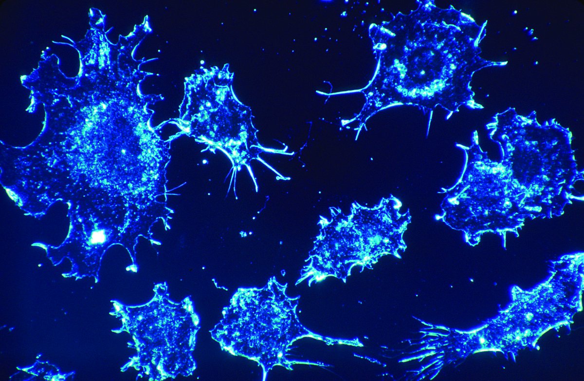 There's so much talk about new revolutionary therapies for cancer but what does it actually mean? Read about nanoparticles for treating cancer from our latest issue! By Meng Lou. justjournal.org/2017/12/14/nan…