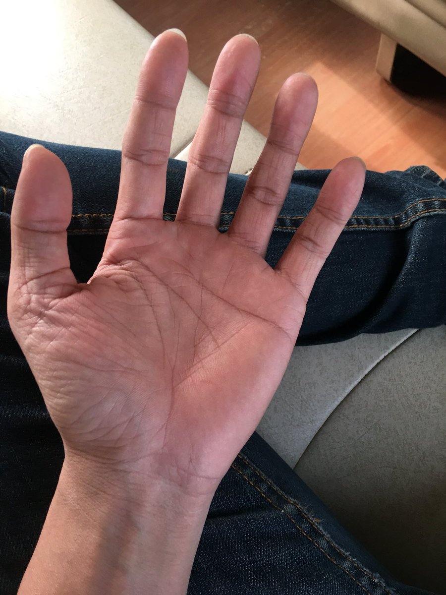 ขอจับมือหน่อย