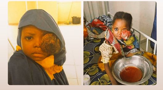 Rayyan_Tukur's tweet photo. Ramatu suleiman surgery is rescheduled to 10th and 20th January 2018 due to lack of funds, she still need 180k for the surgery!!😢😧 Please help save a life🙏 
Account details - 0044486500 
Diamond Bank.
No amount is too small, and don't forget to RETWEET.
Thank - You🙌❤️ https://t.co/P3evl7gKni