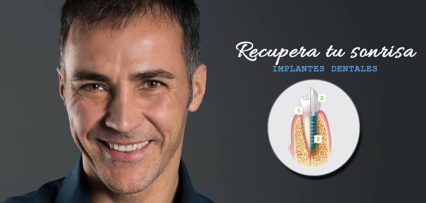 Clidenmax's tweet photo. La manera más funcional y estética de recuperar un diente perdido, no hay duda, son los implantes dentales . Sonríe con confianza #ImplantesDentales https://t.co/06ZIT5xo7H https://t.co/FjMV6Blff5