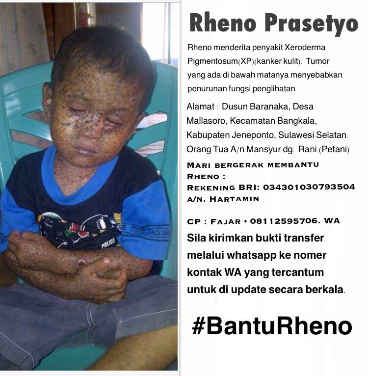 andivox's tweet photo. Dapat info dari WAG kawan2 di Makassar tentang adik Rheno, anak seorang petani yang membutuhkan bantuan kita semua. Kawan-kawan yuk kita bantu agar adik Rheno mendapatkan penanganan terbaik, semoga Allah memberikan kesembuhan untuknya, Rheno kamu kuat nak! #BantuRheno cc @qitmr https://t.co/zDWwAmku9D