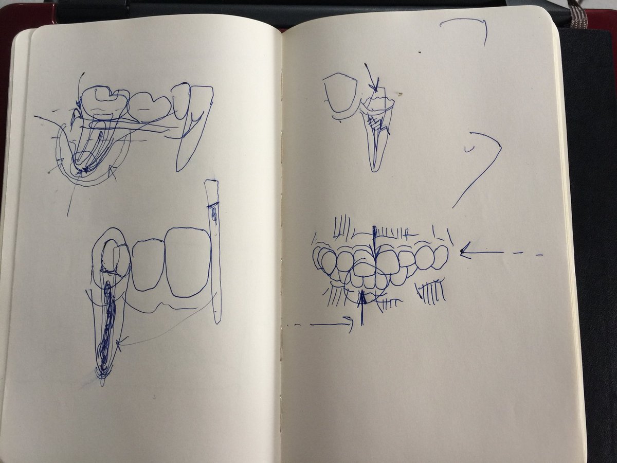 PulpiteBlog's tweet image. Às vezes o moleskine é só diagramas loucos para pacientes aflitos em dúvidas.