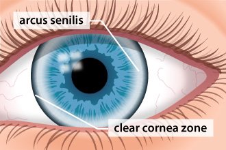 alldaygeneric's tweet photo. cornea allows light to ==> https://t.co/BKOgsFlA80
#eye #blindness #eyepressure #vision #lasersurgery #openangle #angleclosure #causes #riskfactors #age #treatment #symptoms #prevention Alldaygeneric #Alldaygeneric #BuyGenericMedicinesOnline #BestOnlinePharmacies #OnlinePharmacy https://t.co/g7oNymULpY