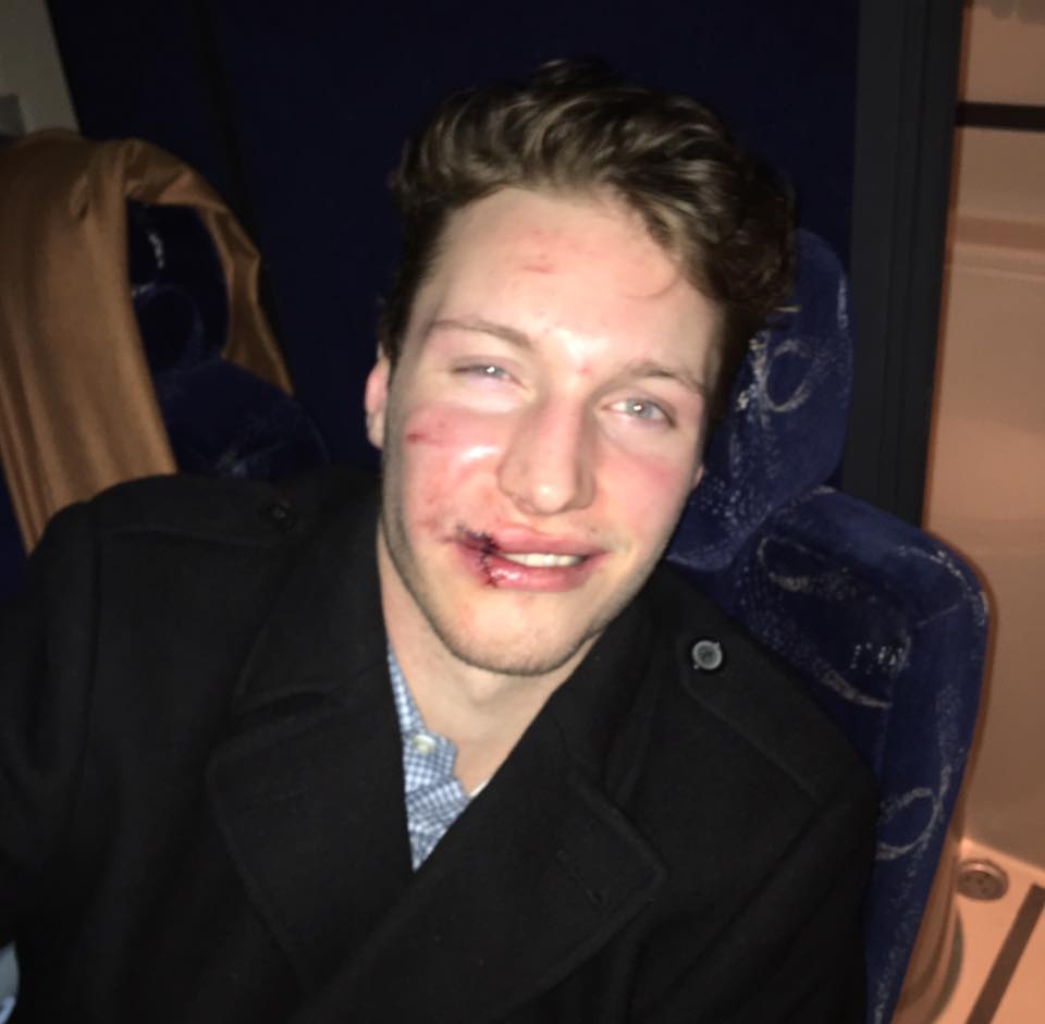 More than a few shoutouts for <a href="/Evan_Fiala/">Evan Fiala</a> on the show today for blocking a slap shot with his face. Good Clavet kid right there! <a href="/BladesHockey/">Saskatoon Blades</a>