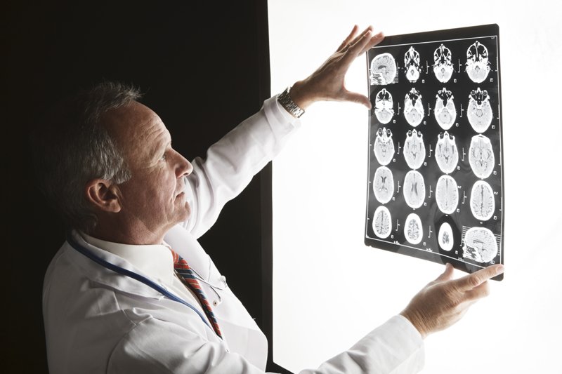 alzMNND's tweet photo. Do you know how Alzheimer's affects the brain? Take our interactive tour to see how different a brain with this disease looks. https://t.co/F12J7skNak #braintour #themoreyouknow #Alzheimers https://t.co/MUS97unM1o