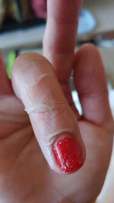 Just burned the shit out of my hand...fuck it hurts! https://t.co/xzqKNHuxfz<a href="/tag/sucker"class="tags"><span>#sucker</span></a>