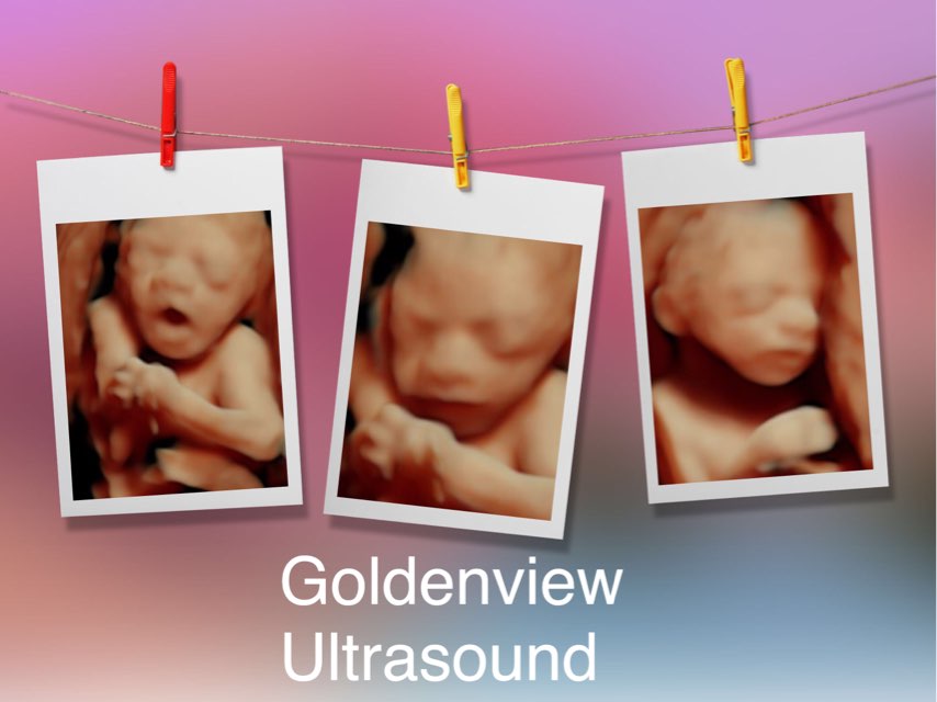 3d4dUltrasound's tweet photo. 26 weeks, a well hydrated mom and an active baby made for an adorable ultrasound session. #3dultrasound #26weeks #goldenview https://t.co/nSWN7qaQvZ