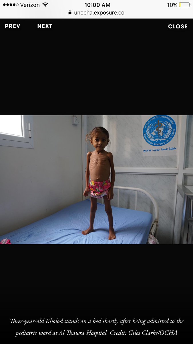 rabyaahahmed's tweet photo. The U.S. must end its complicity in Saudi's disastrous war in #Yemen. 17M starving, 1M w/ cholera. #HandsOffYemen #HConRes81 https://t.co/R1U3PMkmlP