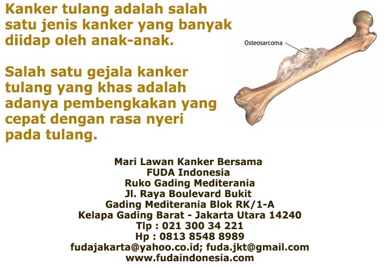 Kanker tulang adalah salah satu jenis kanker yang paling sering diidap oleh anak-anak. Inilah #gejalakanker yang harus diwaspadai