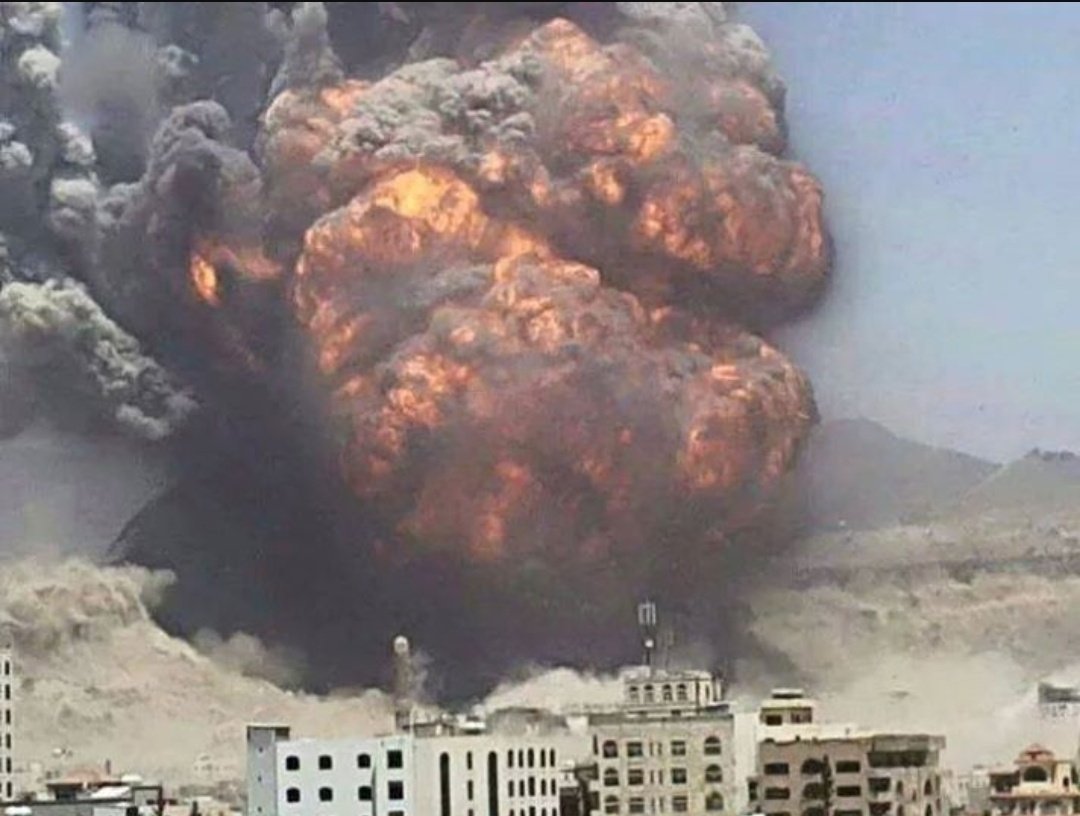 Marwa__Osman's tweet photo. #2017inReview usually presents the persona of the year ..this year and every year until #AlSaud 's barbarism is STOPPED,
the Kids of #Yemen will be the personas of every year's end.
One stands helpless at these photos..but we all collectively CAN make a change #AgainstAlSaud https://t.co/rsZk4cuZLg