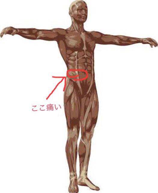 が 右 痛い 脇腹 おなかのどの辺が痛いですか？痛みの位置で原因がわかるかも。