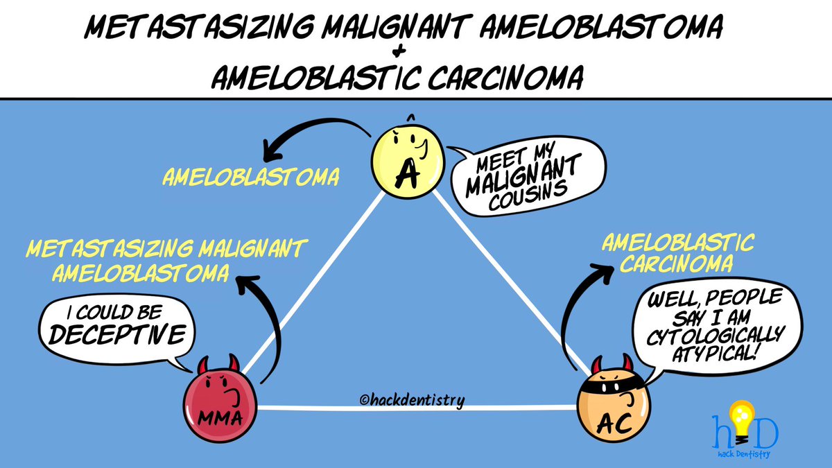 #malignantameloblastoma and #ameloblasticcarcinoma are two rare malignant counterparts of ameloblastoma that could metastasize to distant organs, especially lungs! Watch the video: youtu.be/uJIdH9677TI
#hackdentistry #oralpathology #odontogenictumors