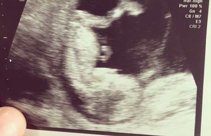 frankbrunoboxer's tweet photo. My daughter @bruno_rachel &amp;  @ohhbobbyhardy84 will be welcoming their first baby in July, I'm absolutely over the moon to be Grandpa Frank 👣 https://t.co/5r49HMiape